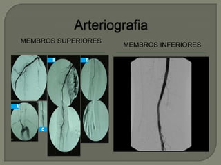 MEMBROS SUPERIORES
MEMBROS INFERIORES
 