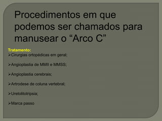 Procedimentos em que
podemos ser chamados para
manusear o “Arco C”
Tratamento:
Cirurgias ortopédicas em geral;
Angioplastia de MMII e MMSS;
Angioplastia cerebrais;
Artrodese de coluna vertebral;
Uretolitotripsia;
Marca passo
 