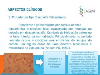 ASPECTOS CLÍNICOS
2. Portador do Tipo Traço Alfa Talassêmico
O paciente é caracterizado por possuir anemia
hipocrômica microcítica leve, ocasionada por mutação ou
deleção em dois genes alfa. Os níveis de HbA estão baixos ou
na faixa inferior da normalidade. Principalmente no período
neonata ocorre microcitose nos eritrócitos do sangue do
cordão. Em alguns casos há uma discreta hipocromia e
microcitose na vida adulta (Naoum PC, 1997).
Microcitose é a
diminuição do
tamanho dos
eritrócitos
As anemias microcíticas e
hipocrômicas são as mais
prevalentes no mundo e sua
causa é o descompasso entre a
síntese de hemoglobina e a
proliferação eritróide, tornando as
hemácias menores pela falta de
conteúdo em seu estroma
elástico (OLIVEIRA; POLI NETO,
2004; GUALANDRO, 2000).
 