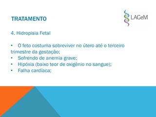 4. Hidropisia Fetal
• O feto costuma sobreviver no útero até o terceiro
trimestre da gestação;
• Sofrendo de anemia grave;
• Hipóxia (baixo teor de oxigênio no sangue);
• Falha cardíaca;
TRATAMENTO
 
