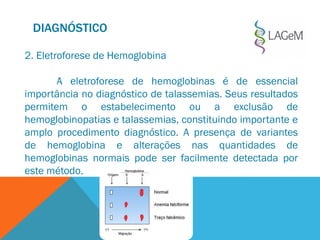 DIAGNÓSTICO
2. Eletroforese de Hemoglobina
A eletroforese de hemoglobinas é de essencial
importância no diagnóstico de talassemias. Seus resultados
permitem o estabelecimento ou a exclusão de
hemoglobinopatias e talassemias, constituindo importante e
amplo procedimento diagnóstico. A presença de variantes
de hemoglobina e alterações nas quantidades de
hemoglobinas normais pode ser facilmente detectada por
este método.
 
