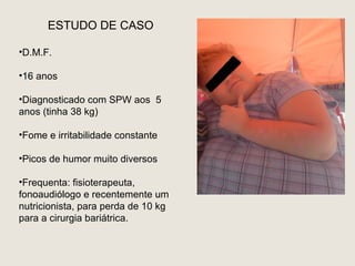 ESTUDO DE CASO

•D.M.F.

•16 anos

•Diagnosticado com SPW aos 5
anos (tinha 38 kg)

•Fome e irritabilidade constante

•Picos de humor muito diversos

•Frequenta: fisioterapeuta,
fonoaudiólogo e recentemente um
nutricionista, para perda de 10 kg
para a cirurgia bariátrica.
 