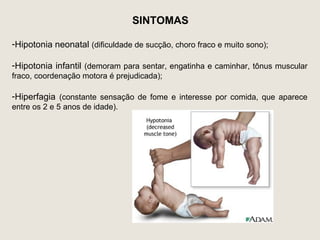 SINTOMAS

-Hipotonia neonatal (dificuldade de sucção, choro fraco e muito sono);

-Hipotonia infantil (demoram para sentar, engatinha e caminhar, tônus muscular
fraco, coordenação motora é prejudicada);

-Hiperfagia (constante sensação de fome e interesse por comida, que aparece
entre os 2 e 5 anos de idade).
 
