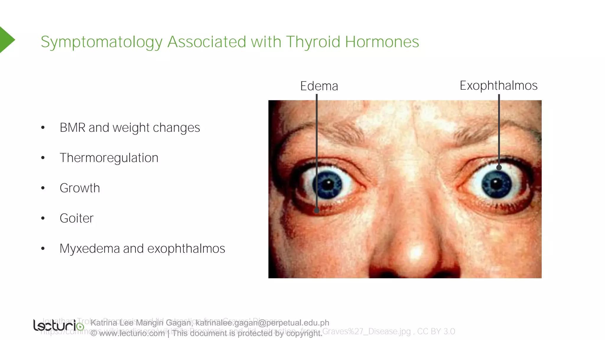 Slides Thyroid Endocrine System Pdf