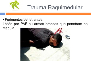 Trauma Raquimedular
• Ferimentos penetrantes:
Lesão por PAF ou armas brancas que penetram na
medula.
 