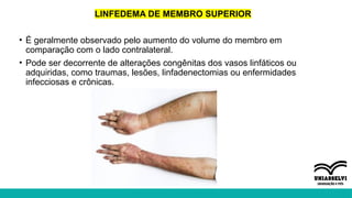 LINFEDEMA DE MEMBRO SUPERIOR
• É geralmente observado pelo aumento do volume do membro em
comparação com o lado contralateral.
• Pode ser decorrente de alterações congênitas dos vasos linfáticos ou
adquiridas, como traumas, lesões, linfadenectomias ou enfermidades
infecciosas e crônicas.
 