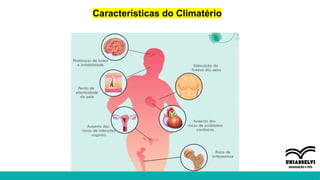 Características do Climatério
 