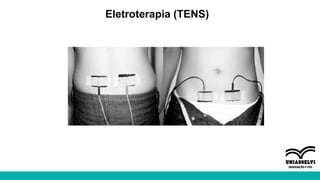 Eletroterapia (TENS)
 