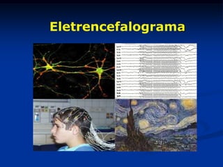 Eletrencefalograma
 