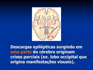 Descargas epilépticas surgindo em
uma parte do cérebro originam
crises parciais (ex. lobo occipital que
origina manifestações visuais).
 