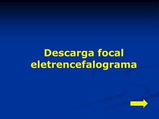 Descarga focal
eletrencefalograma
 