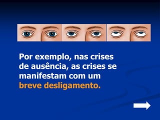 Por exemplo, nas crises
de ausência, as crises se
manifestam com um
breve desligamento.
 