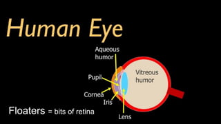 Floaters = bits of retina
 