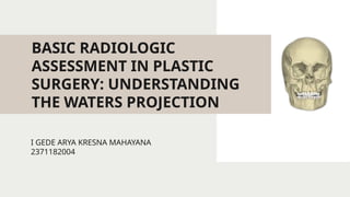 clinical use of waters projection in determining sinus problems | PPTX