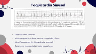 - Uma das mais comuns;
- Hiperautomatismo do nó sinusal + condição clínica;
- Identificar causas (ex: hipovolemia, anemia);
- Raramente inapropriada > tratar causa base;
Taquicardia Sinusal
 