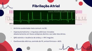 - Arritmia sustentada mais comum no DE;
- Hiperautomatismo + impulsos elétricos iniciados
aleatoriamente em focos ectópicos dentro e ao redor dos átrios;
- QRS estreito + Ausência de onda p + RR irregular;
- Cardioversão elétrica, controle de FC, antiarrítmicos + ACO;
FibrilaçãoAtrial
 