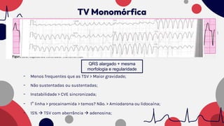 - Menos frequentes que as TSV > Maior gravidade;
- Não sustentadas ou sustentadas;
- Instabilidade > CVE sincronizada;
- 1º linha > procainamida > temos? Não. > Amiodarona ou lidocaína;
- 15%  TSV com aberrância  adenosina;
QRS alargado + mesma
morfologia e regularidade
TV Monomórfica
 