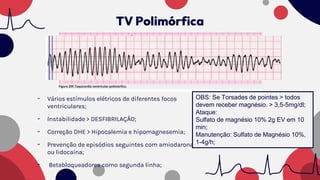 - Vários estímulos elétricos de diferentes focos
ventriculares;
- Instabilidade > DESFIBRILAÇÃO;
- Correção DHE > Hipocalemia e hipomagnesemia;
- Prevenção de episódios seguintes com amiodarona
ou lidocaína;
- Betabloqueadores como segunda linha;
OBS: Se Torsades de pointes > todos
devem receber magnésio. > 3,5-5mg/dl;
Ataque:
Sulfato de magnésio 10% 2g EV em 10
min;
Manutenção: Sulfato de Magnésio 10%,
1-4g/h;
TV Polimórfica
 