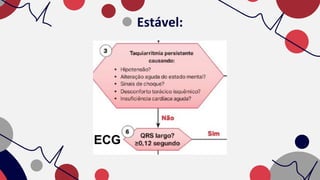 Estável:
ECG
 