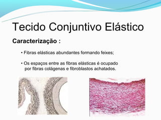 Tecido Conjuntivo Elástico
Caracterização :
  • Fibras elásticas abundantes formando feixes;

  • Os espaços entre as fibras elásticas é ocupado
    por fibras colágenas e fibroblastos achatados.
 