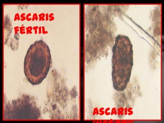 Ascaris
fértil




          Ascaris
 