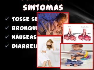   Tosse seca
   Bronquite
   Náuseas
   Diarreia
 