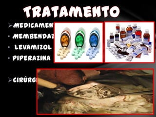Medicamentoso:
• Membendazol
• Levamizol
• Piperazina


Cirúrgico
 