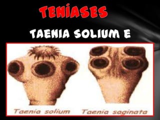 Taenia Solium e
Taenia Saginata
 