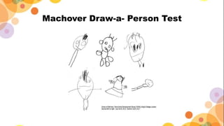 Machover Draw-a- Person Test
 