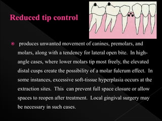  produces unwanted movement of canines, premolars, and
molars, along with a tendency for lateral open bite. In high-
angle cases, where lower molars tip most freely, the elevated
distal cusps create the possibility of a molar fulcrum effect. In
some instances, excessive soft-tissue hyperplasia occurs at the
extraction sites. This can prevent full space closure or allow
spaces to reopen after treatment. Local gingival surgery may
be necessary in such cases.
 