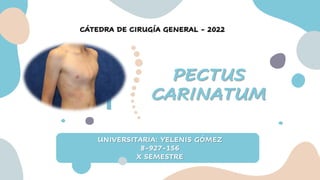 PECTUS
CARINATUM
UNIVERSITARIA: YELENIS GÓMEZ
8-927-156
X SEMESTRE
CÁTEDRA DE CIRUGÍA GENERAL - 2022
 