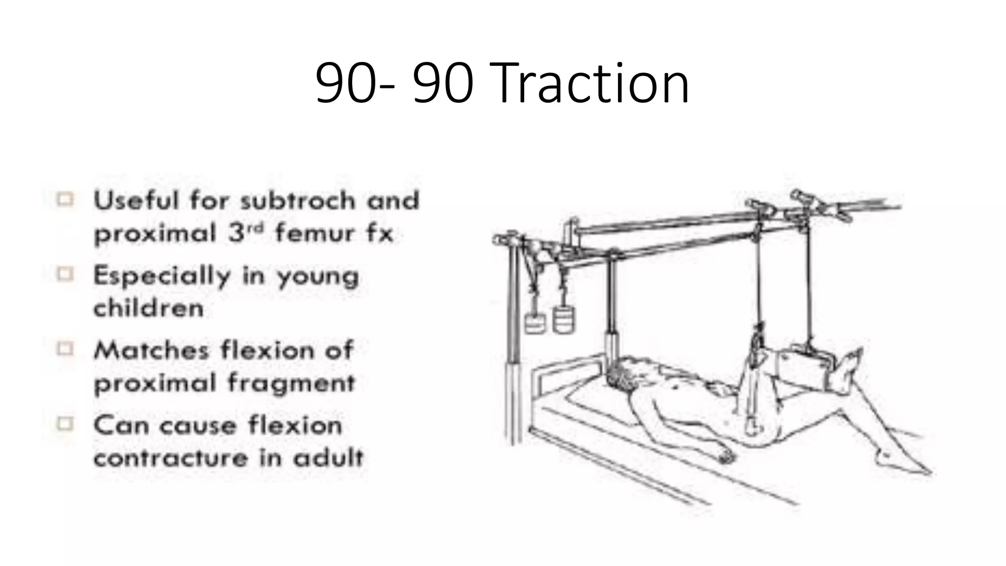 Splints and Tractions