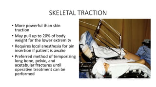 Awak Mathok Splints and Tractions | PPTX