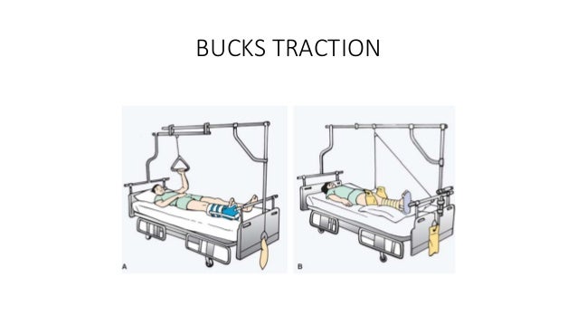 Splints and Tractions