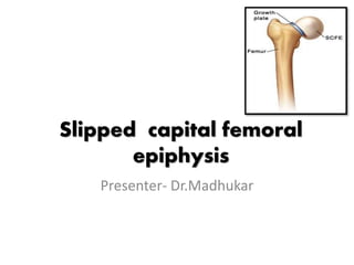Slipped capital femoral
epiphysis
Presenter- Dr.Madhukar
 