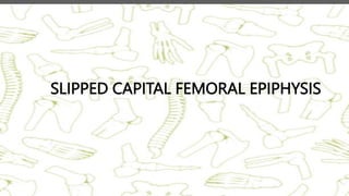 SLIPPED CAPITAL FEMORAL EPIPHYSIS
 