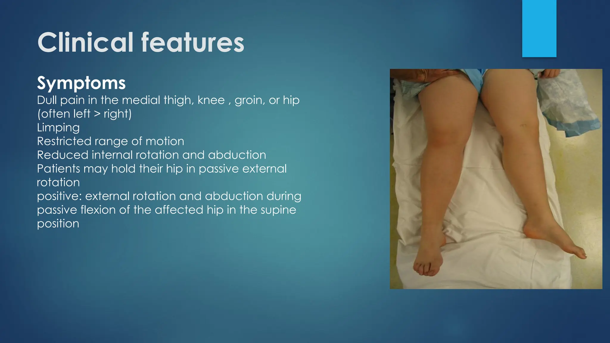 Slipped capital femoral epiphysis (SCFE).pptx