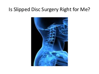 Is Slipped Disc Surgery Right for Me?
 