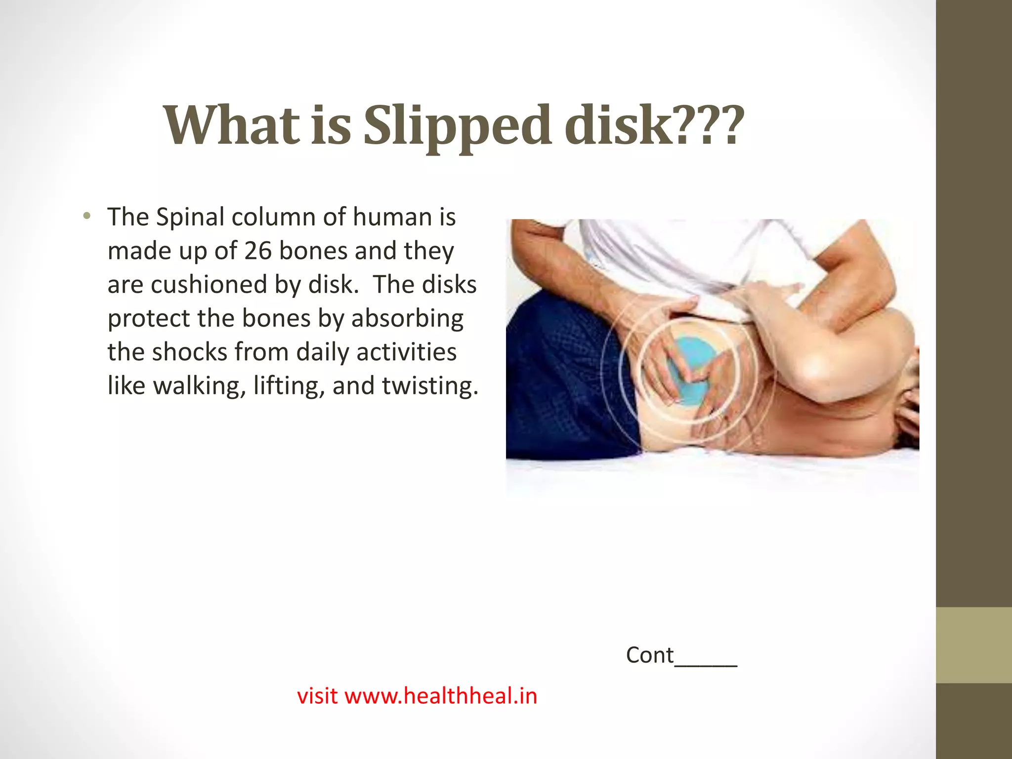 Slipped Disk Rash Slipped disk | PPTX