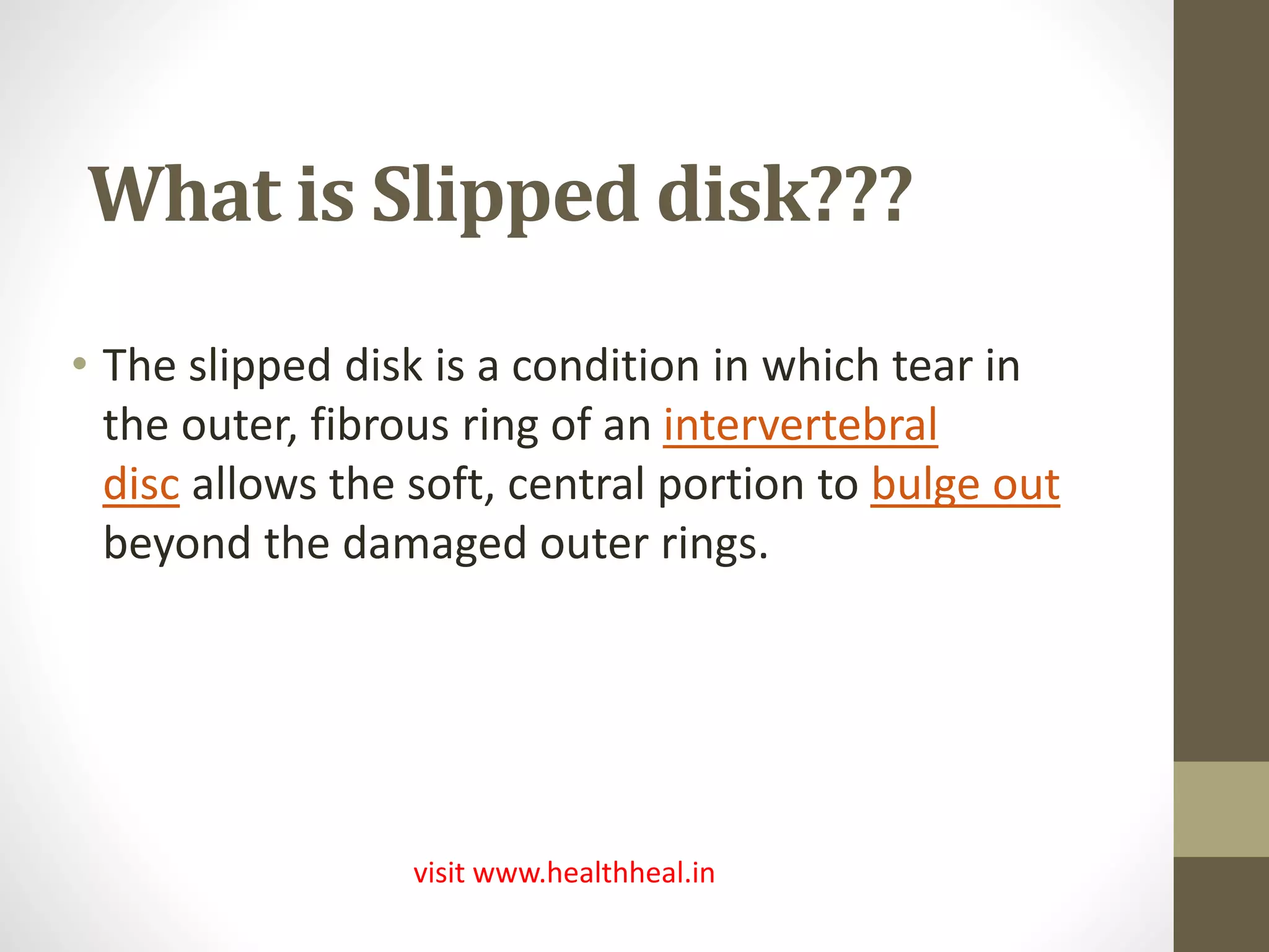 Slipped disk | PPTX