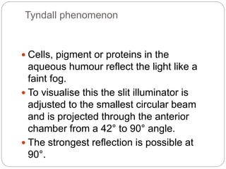 Tyndall phenomenon
 Cells, pigment or proteins in the
aqueous humour reflect the light like a
faint fog.
 To visualise this the slit illuminator is
adjusted to the smallest circular beam
and is projected through the anterior
chamber from a 42° to 90° angle.
 The strongest reflection is possible at
90°.
 
