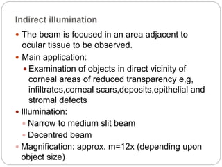 Indirect illumination
 The beam is focused in an area adjacent to
ocular tissue to be observed.
 Main application:
 Examination of objects in direct vicinity of
corneal areas of reduced transparency e,g,
infiltrates,corneal scars,deposits,epithelial and
stromal defects
 Illumination:
 Narrow to medium slit beam
 Decentred beam
 Magnification: approx. m=12x (depending upon
object size)
 