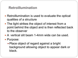 Retroillumination
 Retroillumination is used to evaluate the optical
qualities of a structure
 The light strikes the object of interest from a
point behind the object and is then reflected back
to the observer
 A vertical slit beam 1-4mm wide can be used.
 Purpose:
 Place object of regard against a bright
background allowing object to appear dark or
black.
 