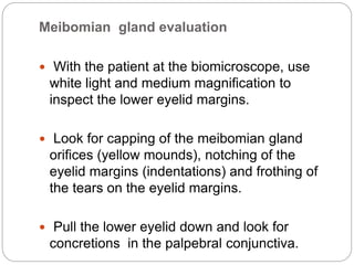 Meibomian gland evaluation
 With the patient at the biomicroscope, use
white light and medium magnification to
inspect the lower eyelid margins.
 Look for capping of the meibomian gland
orifices (yellow mounds), notching of the
eyelid margins (indentations) and frothing of
the tears on the eyelid margins.
 Pull the lower eyelid down and look for
concretions in the palpebral conjunctiva.
 
