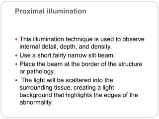 Proximal illumination
 This illumination technique is used to observe
internal detail, depth, and density.
 Use a short,fairly narrow slit beam.
 Place the beam at the border of the structure
or pathology.
 The light will be scattered into the
surrounding tissue, creating a light
background that highlights the edges of the
abnormality.
 