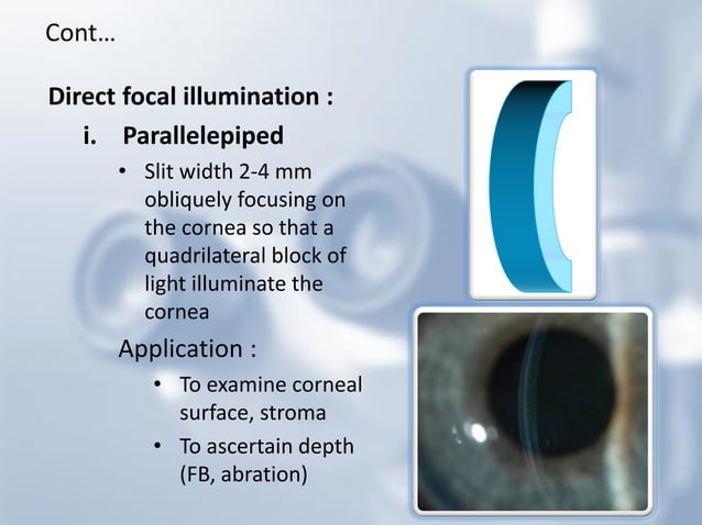 Slit Slide Slit lamp biomicroscope | PDF | Eye and Vision Conditions | Diseases ...