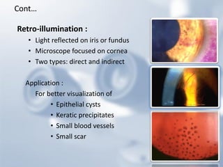 Retro-illumination : 
•Light reflected on iris or fundus 
•Microscope focused on cornea 
•Two types: direct and indirect 
Application : 
For better visualization of 
•Epithelial cysts 
•Keratic precipitates 
•Small blood vessels 
•Small scar 
Cont…  