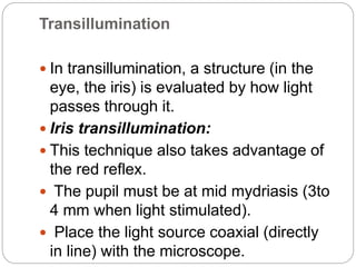 Transillumination
 In transillumination, a structure (in the
eye, the iris) is evaluated by how light
passes through it.
 Iris transillumination:
 This technique also takes advantage of
the red reflex.
 The pupil must be at mid mydriasis (3to
4 mm when light stimulated).
 Place the light source coaxial (directly
in line) with the microscope.
 