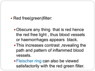  Red free(green)filter:
Obscure any thing that is red hence
the red free light , thus blood vessels
or haemorrhages appears black.
This increases contrast ,revealing the
path and pattern of inflammed blood
vessels.
Fleischer ring can also be viewed
satisfactorily with the red green filter.
 