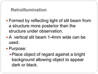 Retroillumination
 Formed by reflecting light of slit beam from
a structure more posterior than the
structure under observation.
 A vertical slit beam 1-4mm wide can be
used.
 Purpose:
Place object of regard against a bright
background allowing object to appear
dark or black.
 